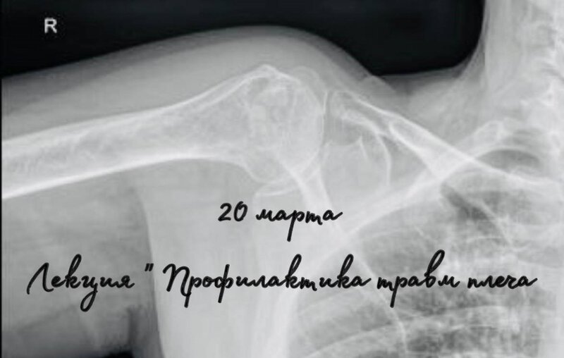 травмы плеча.jpg
